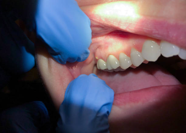 Best Cosmetic Emergency Dentistry in Brown City, MI